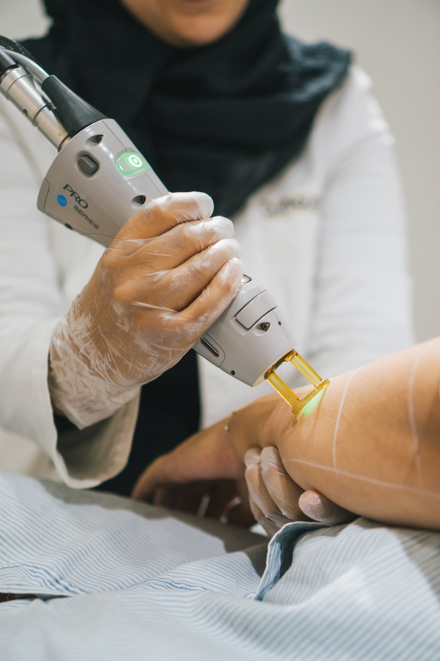 Laserontharing Dames Losse Behandelingen