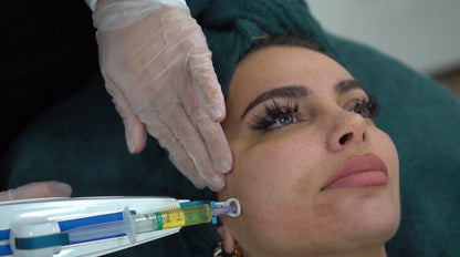 Skinboosters