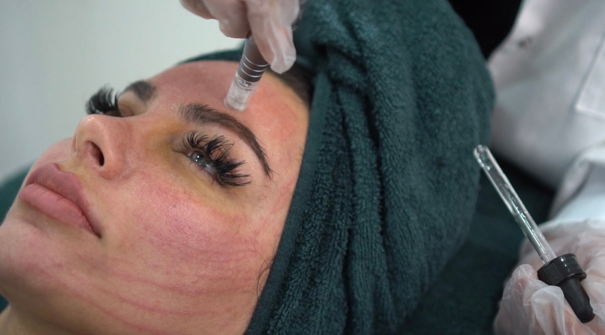 Dermapen